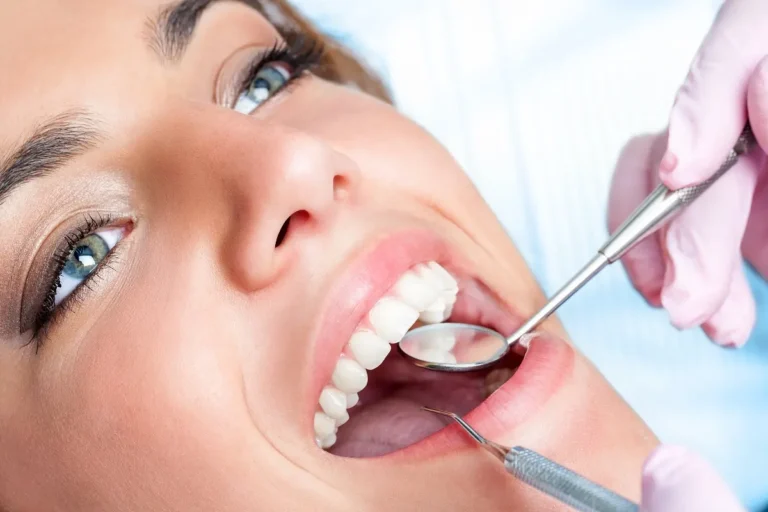 Карієс зубів: причини, симптоми та профілактика