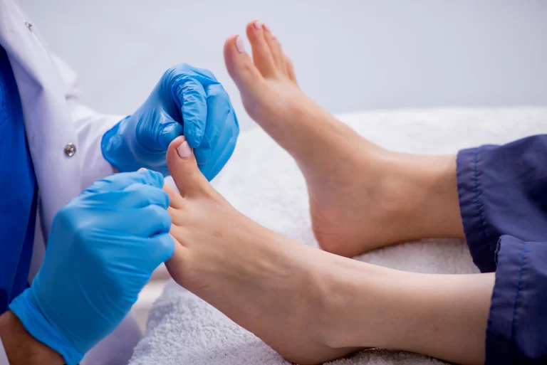 Лікування врослих нігтів на ногах